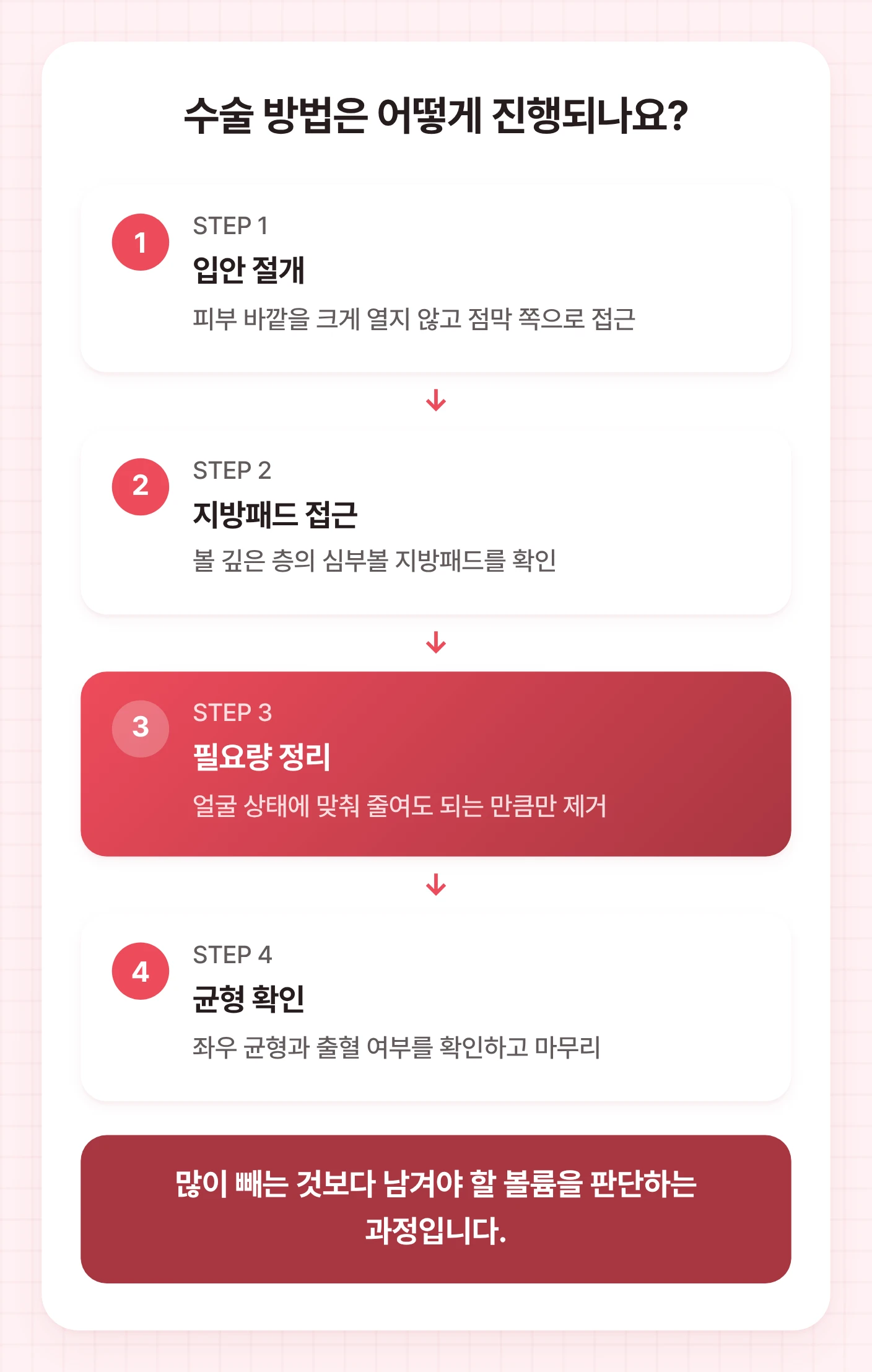 심부볼 제거 수술이 입안 절개, 지방패드 접근, 필요량 정리, 균형 확인 순서로 진행되는 흐름을 보여 주는 도식