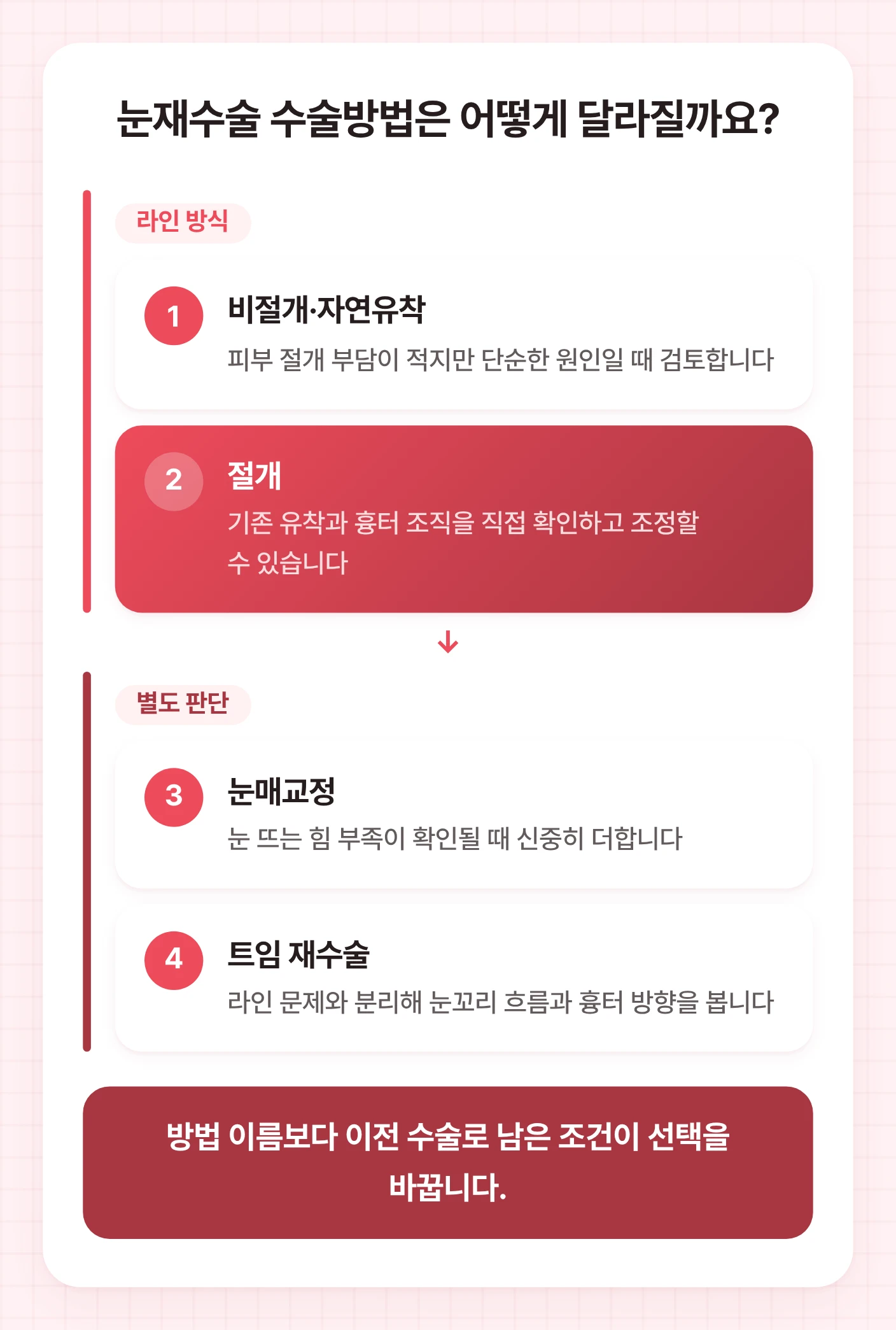 눈재수술 방법을 라인 방식과 별도 판단 항목으로 나누어 절개, 비절개, 눈매교정, 트임 재수술 기준을 보여주는 도식