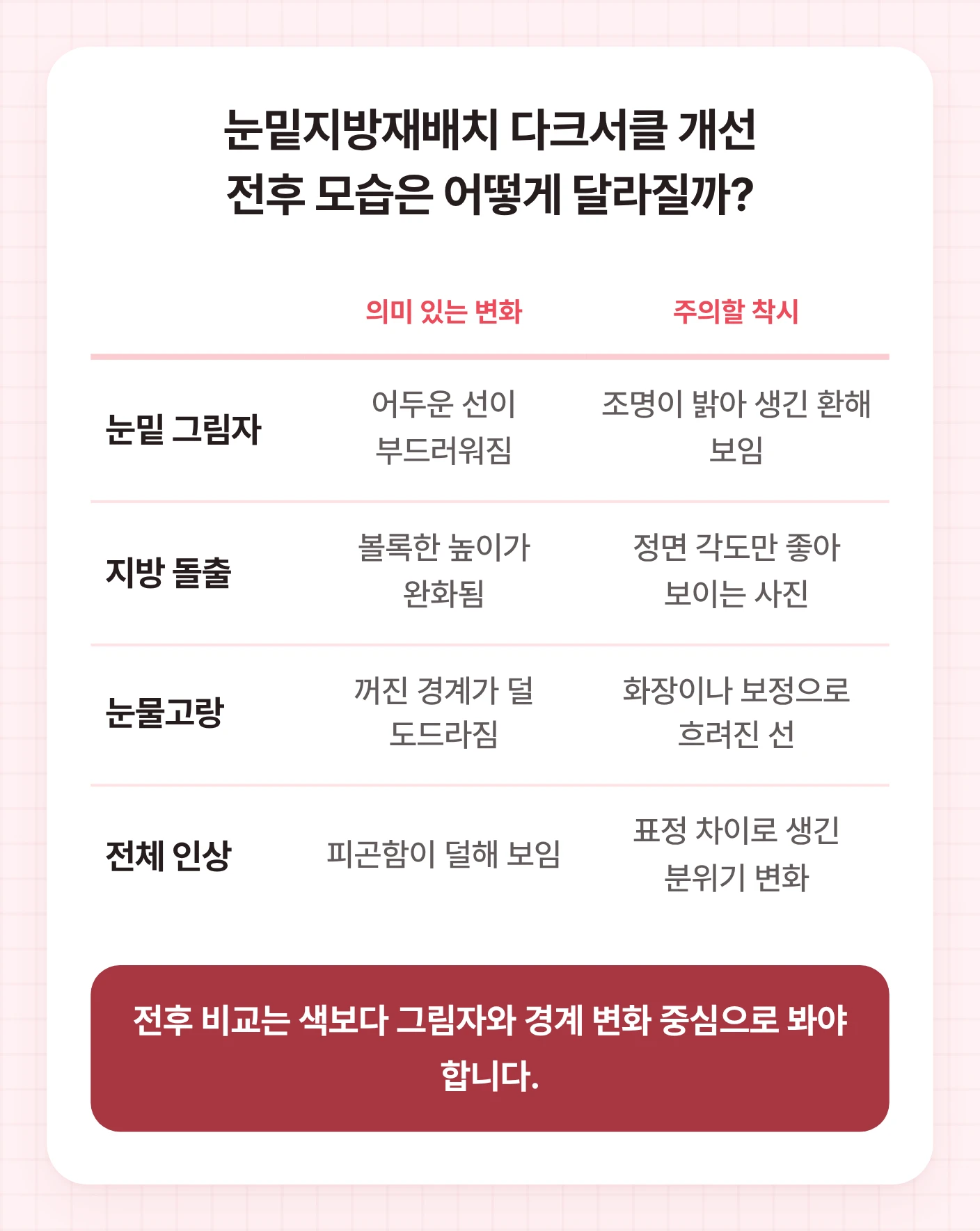 눈밑지방재배치 다크서클 개선 전후 사진에서 봐야 할 변화와 조명·각도·화장 착시를 비교한 표